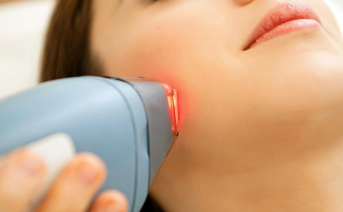 laser_treatment